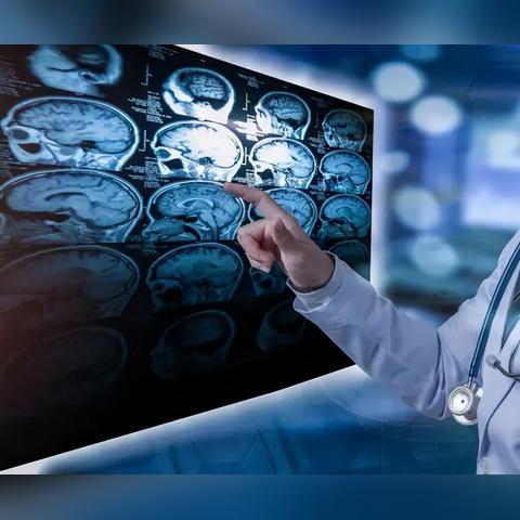 人工智能技术在医疗领域的应用与影响，最新进展及前景展望