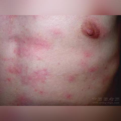 全世界最贵番薯排名,最贵的红薯品种是什么品种