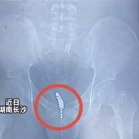 小叶手抓2023最新价格表,品质与价值并重,多样款式满足需求