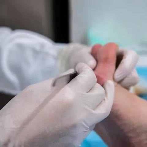 安徽地区跖疣发病率排名及防治重要性分析