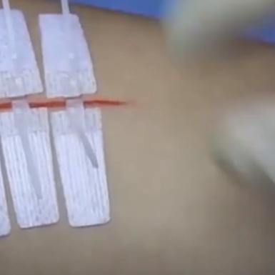 革新伤口护理必备，创口贴特效促进愈合，减少感染风险